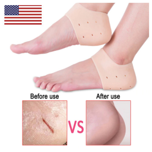 Protective Silicone PLANTAR FASCIITIS Heel Spur Ankle Gel Support Pain Relief
