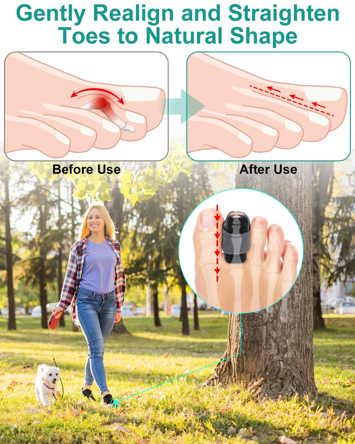 2 Pcs Hammer Toe Straightener with Aluminum Plate Support and 2 Pcs Adjustabl…
