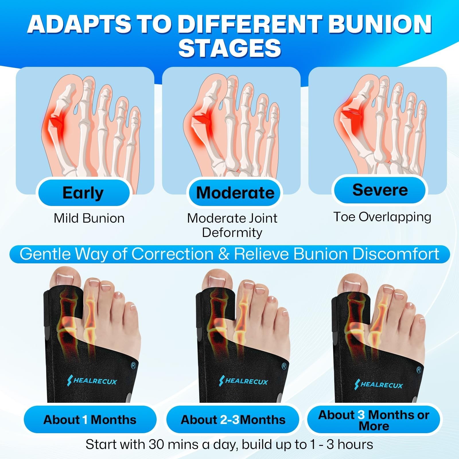 Adjustable Bunion Corrector for Men & Women, Big Toe Straightener Splints with G