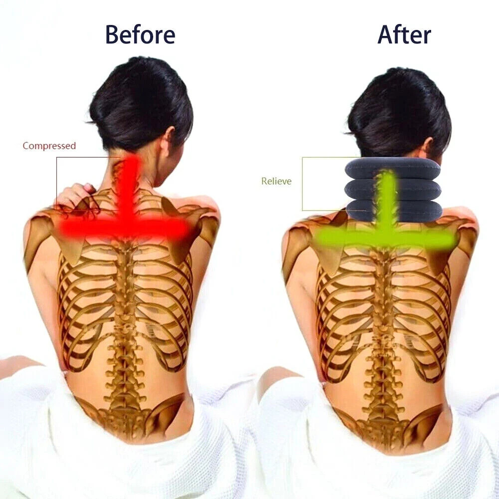 Inflatable Cervical Neck Traction Device Collar Brace Support Pain Relief