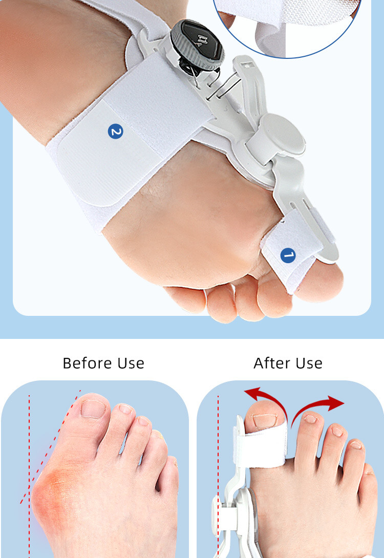 Unisex Bunion Corrector Hallux Valgus Corrector Orthopedic Big Toe Separator NCW