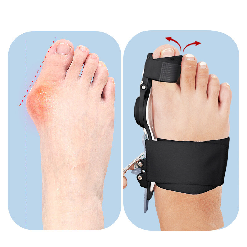 Bunion Splint Big Toe Straightener Corrector Knob Hallux Valgus Orthopedic Strap