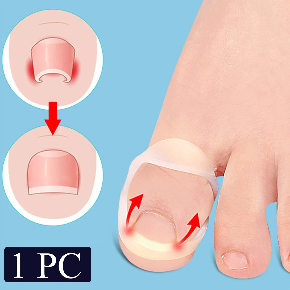 Silicone Ingrown Toenail Correction Tool Invisible Ingrown Toe Nail Straightenin