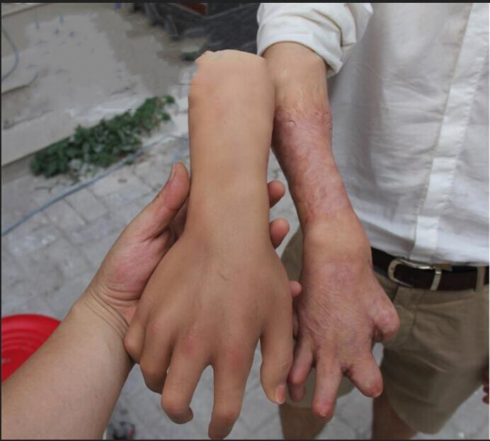 Highly Simulated Silicone Prosthesis Hand Sleeve Artificial Arm Cover Scars