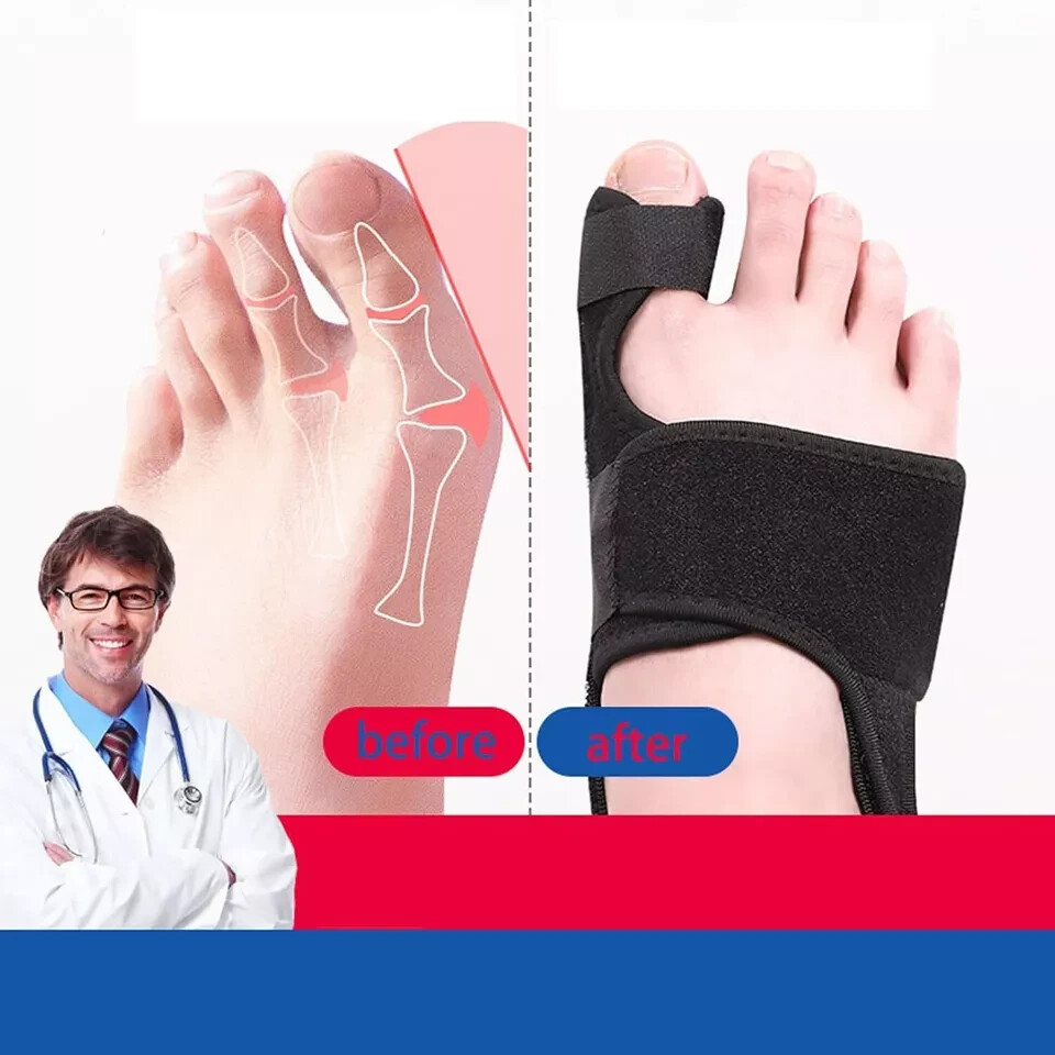 Toe Separators, Foot Toe Splint For Big Toe (1 Pair, Black)