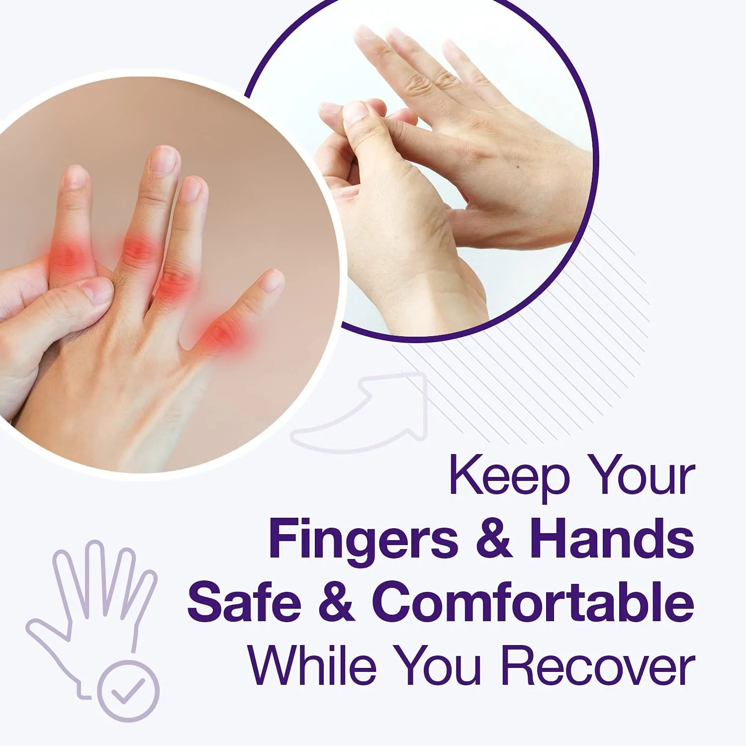 Aluminum Padded Finger Splint Immobilizer for acute injury and Knuckle Fracture