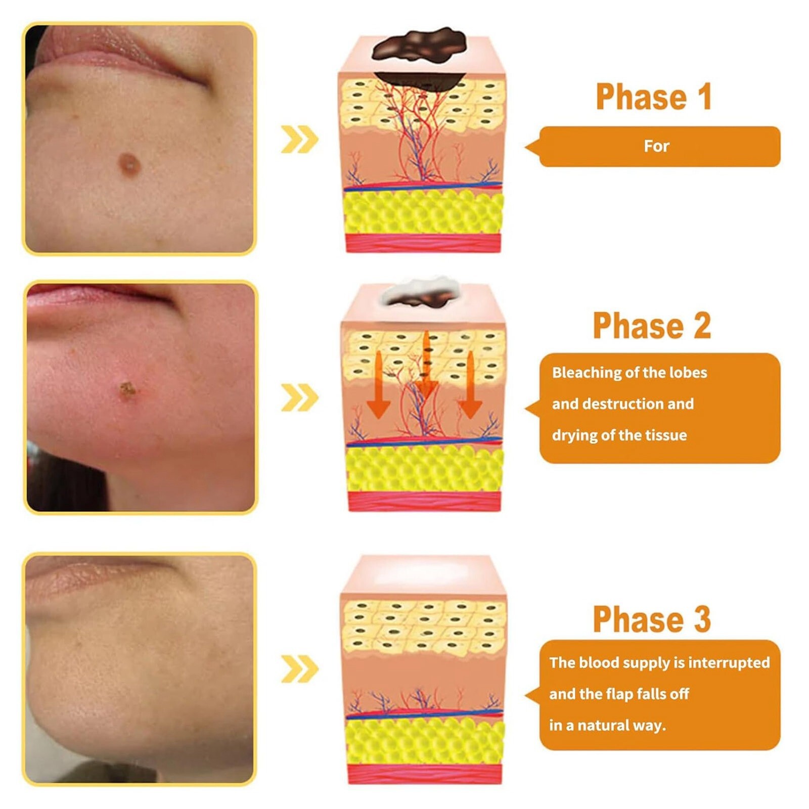 ZOENCGZ Bee Venom Pro-Grade Gel Repair Cream Hydrating Moisturizing Men&Women