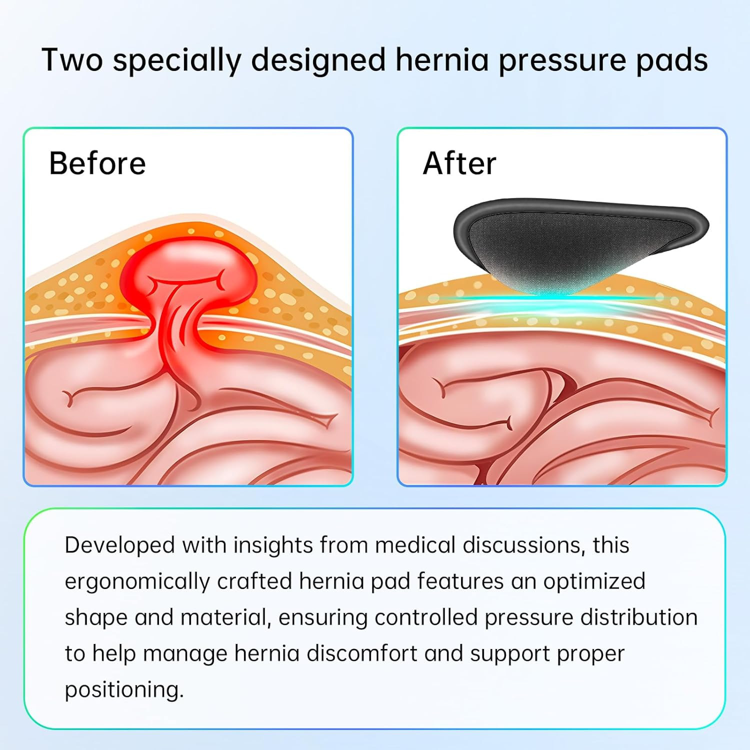 Hernia Belt for Men – Adjustable Support Brace, Comfortable & Breathable Design,