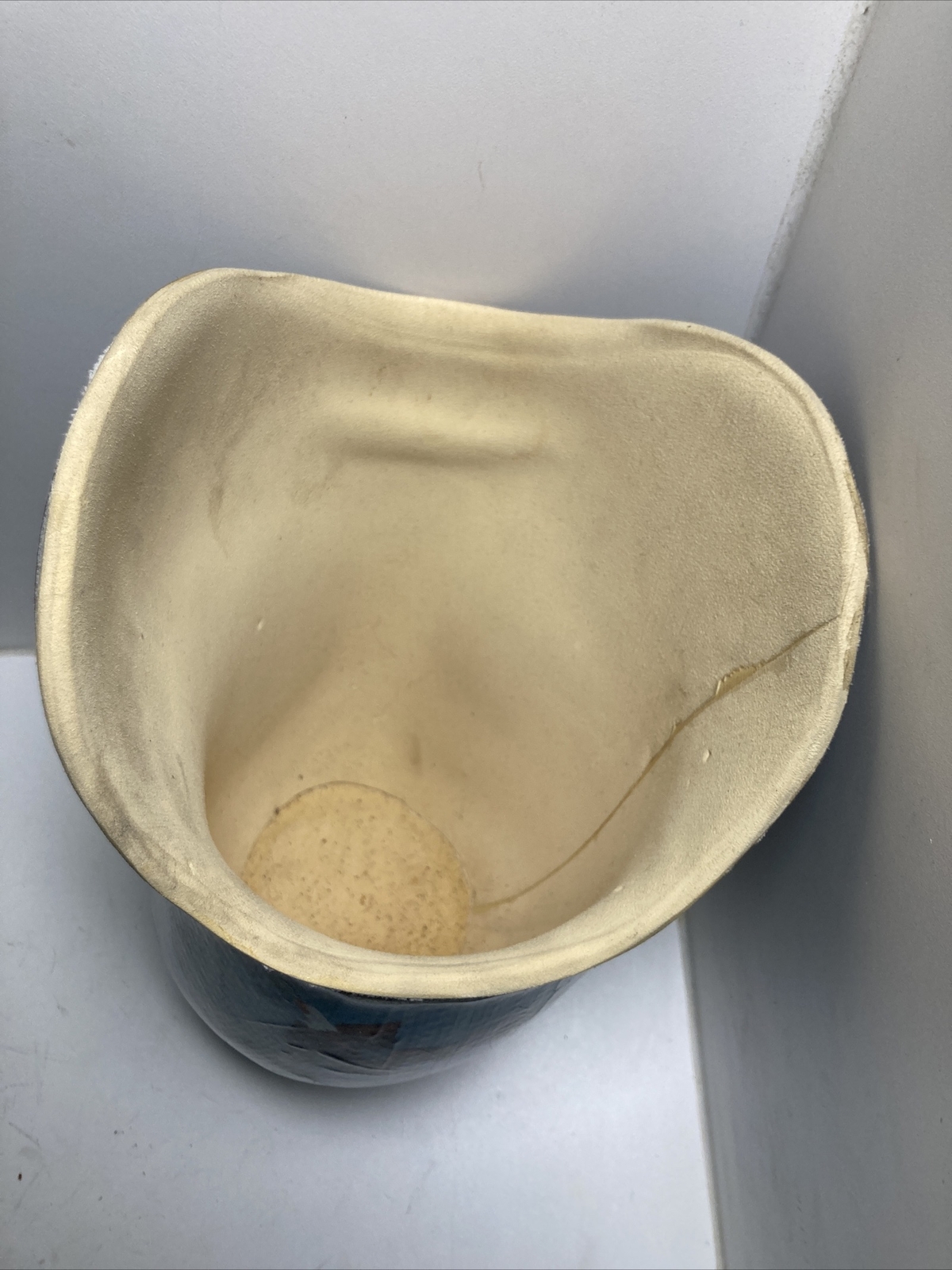 Prosthetic Above Knee Leg Socket ?Right Left?