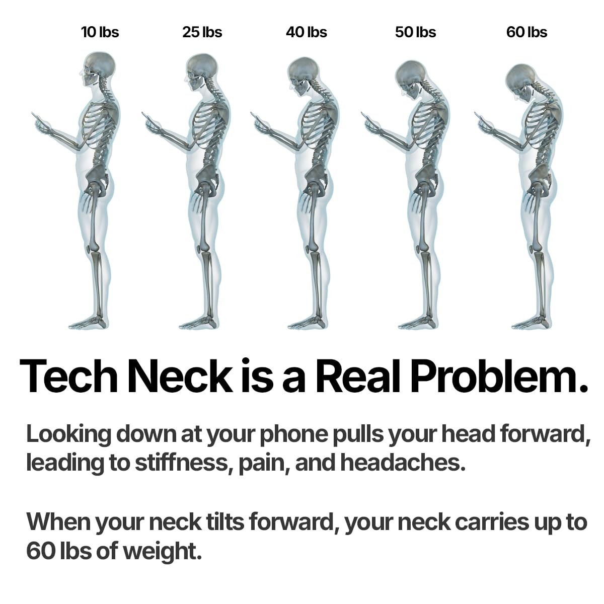 Neck Exercise Device for Pain Relief & Posture Improvement – Adjustable, Portabl
