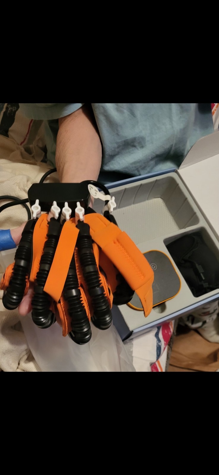 Upgraded Rehabilitation Robotic Gloves for Hempiplegia Stroke Paralysis Arthriti