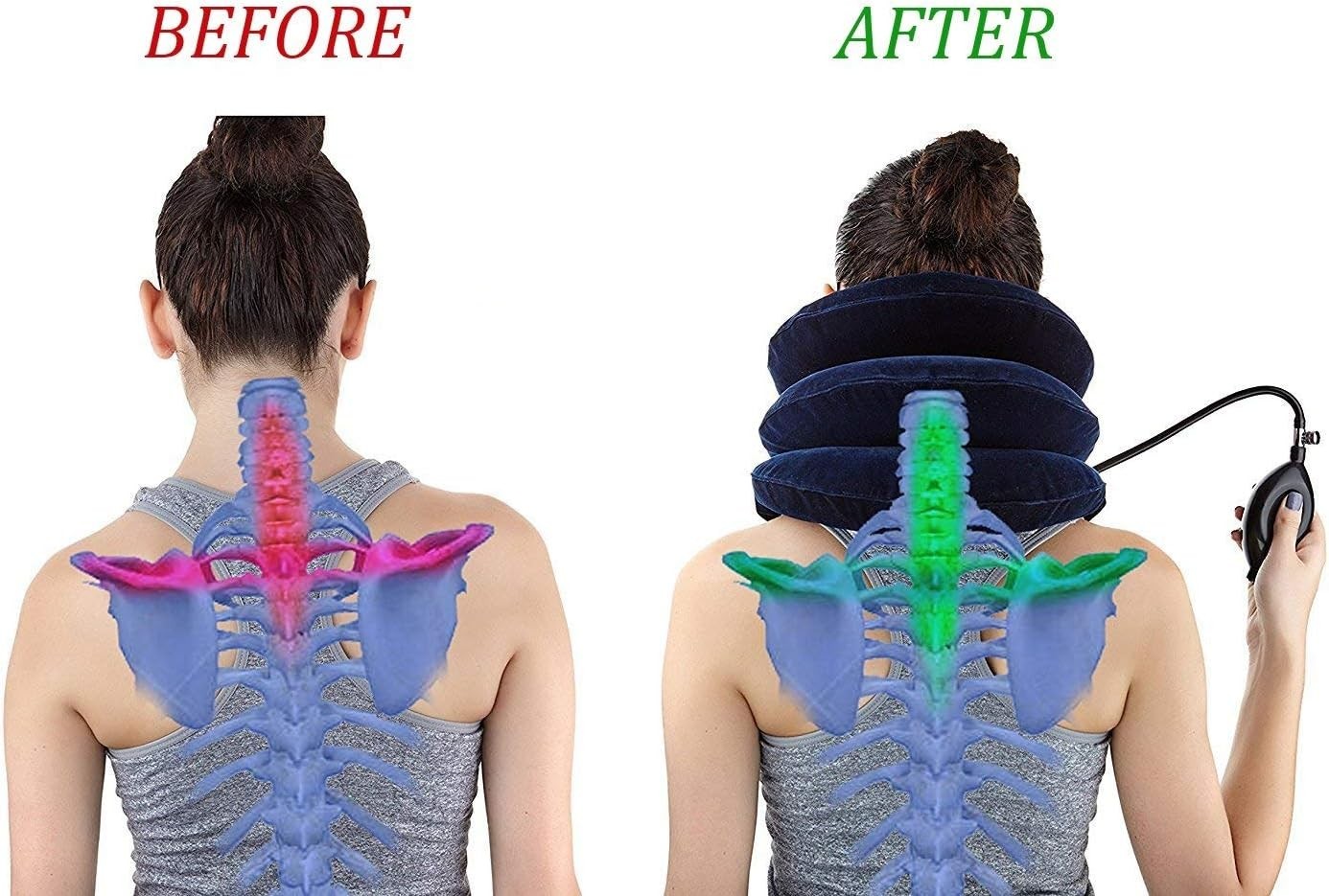 Cervical Neck Traction Device Inflatable Neck Stretcher, Easy to Use for Chro…
