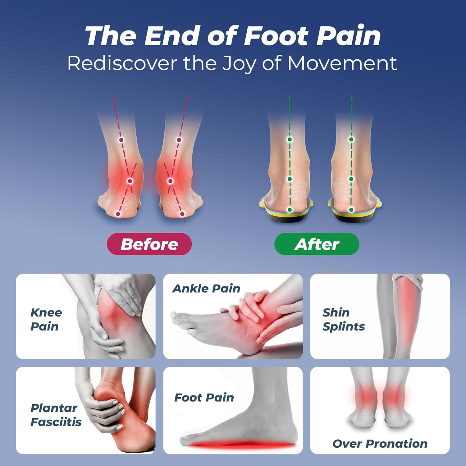 Professional Heavy Duty Support Pain Relief Orthotics – Over 230+ lbs Plantar Fa