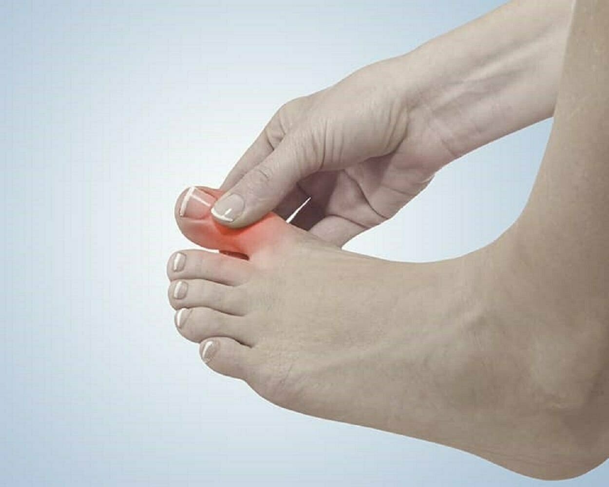 Bunion Corrector Toe Separators and Spreaders Bunion Pads for Pain Relief – 1 Pr