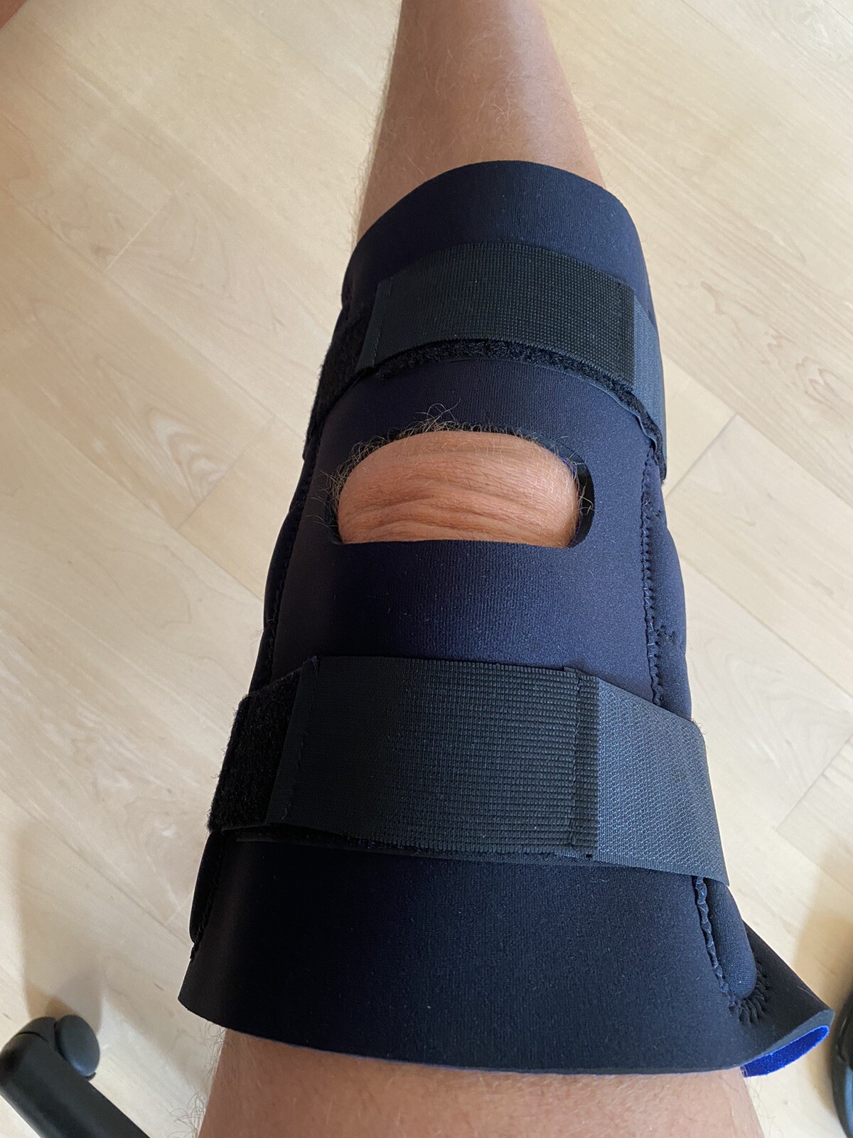 Dynatronics knee Support, Open kneecap Stabilizer with Adjustable Strap, Hinged