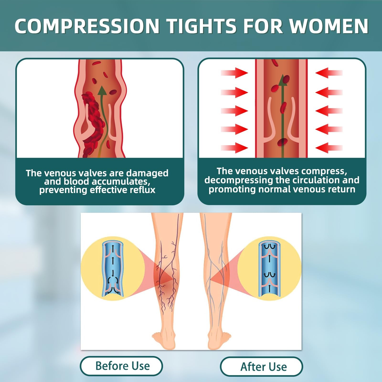 2 Pairs 20-30mmHg Compression Pantyhose for Women, Medical Graduated Compress…