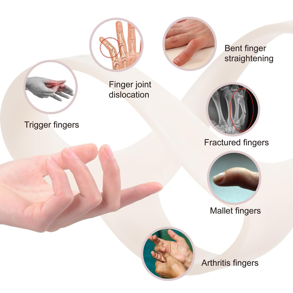 Oval Finger Splint 8 Pcs, Finger Splints for Arthritis, Mallet Finger, Trigger F