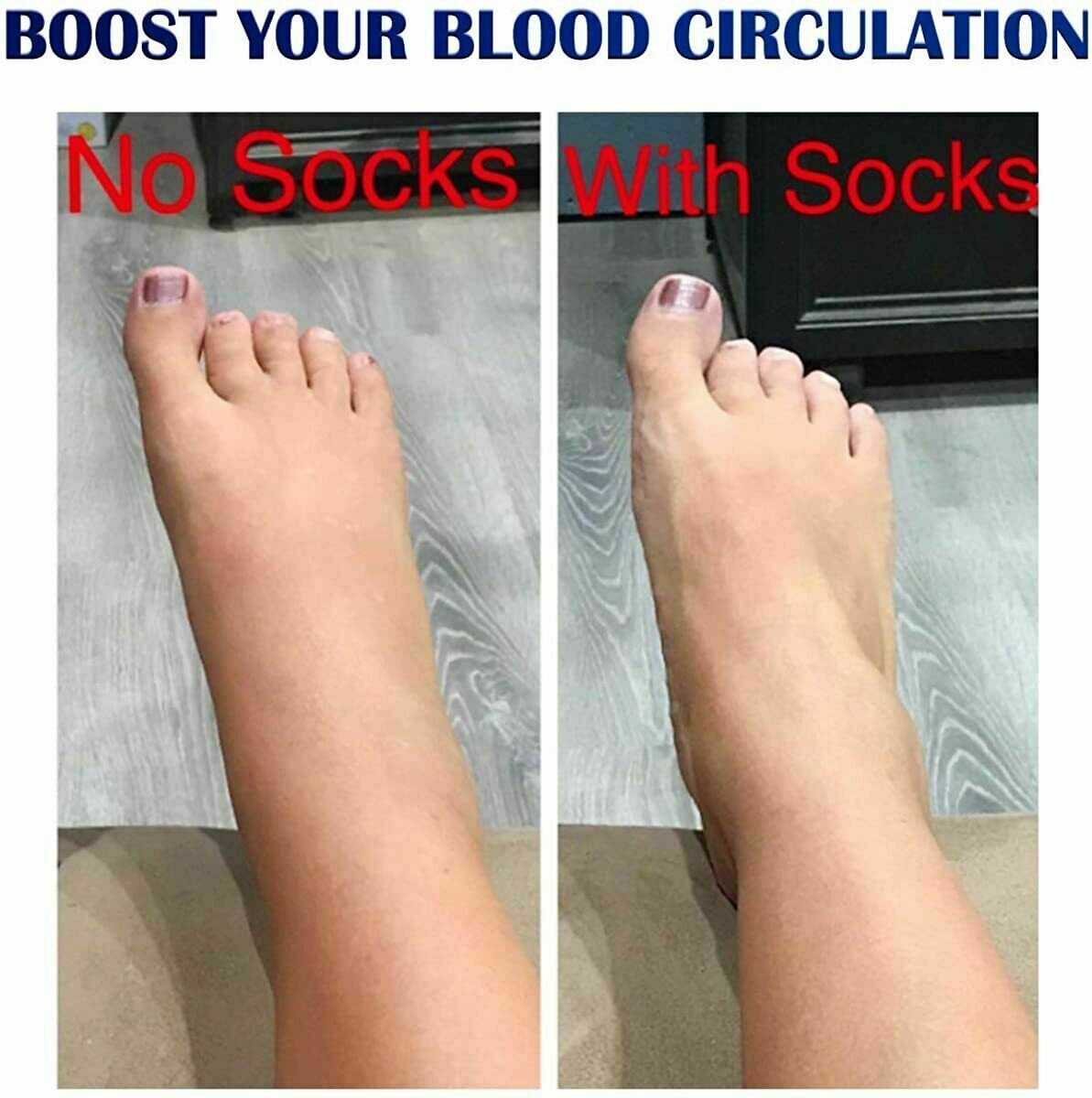 Copper Medical Compression Socks Zipper Leg Calf Ankle Support Men Women S-XXL