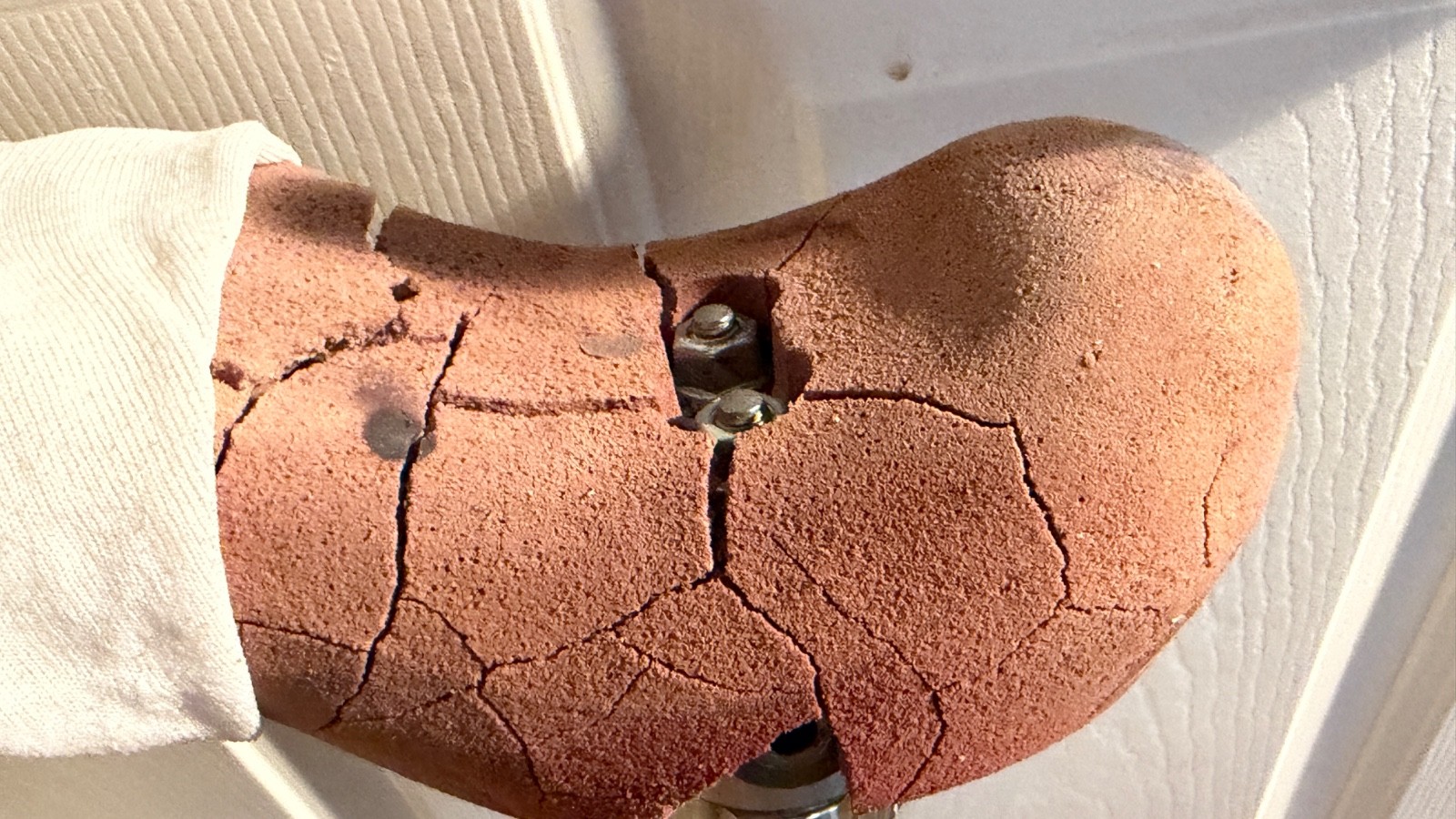 Vintage Ottobock Titan Left – Above the knee with Original Stub