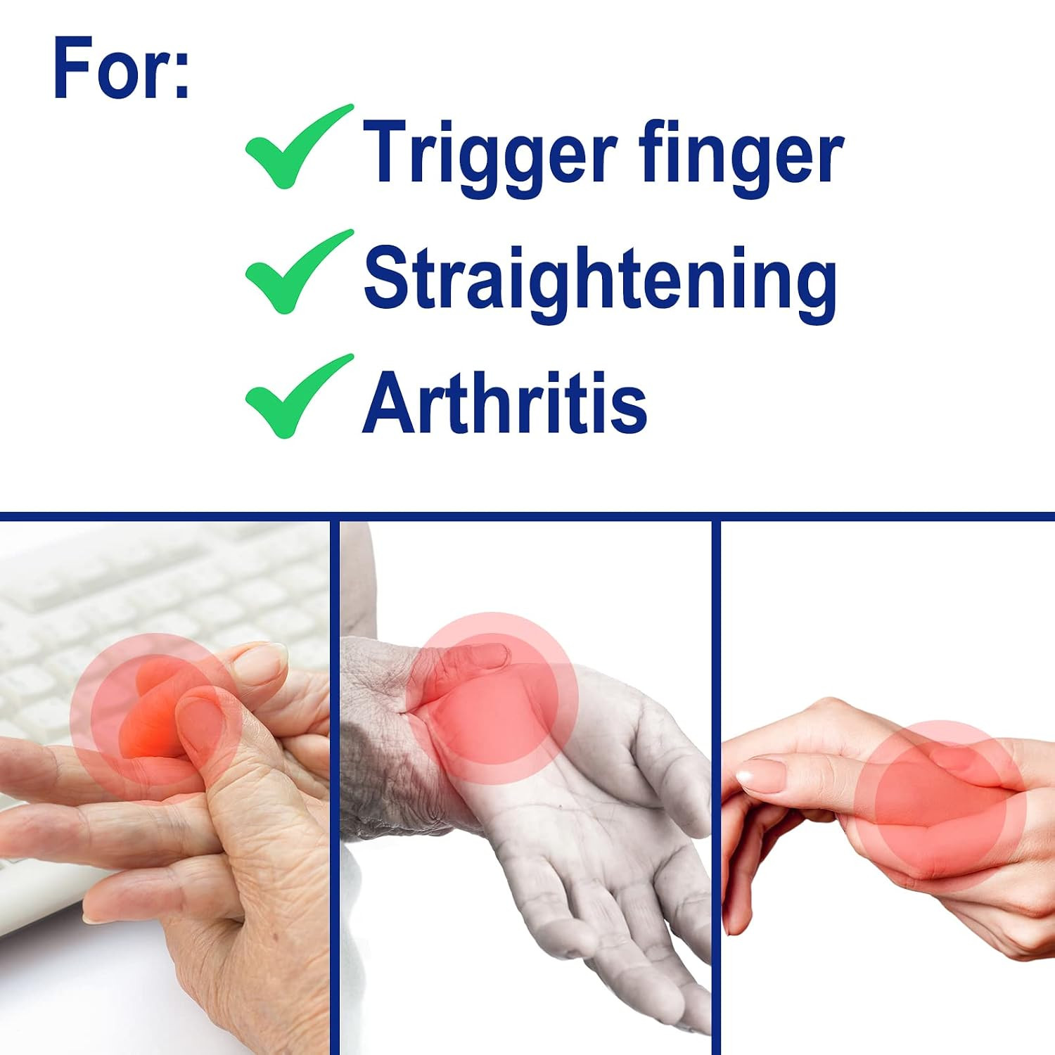 5 Pcs Trigger Finger Splints: 5 Single Straps Finger Splint Support Brace Kit, F