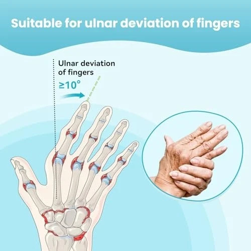 Finger Ulnar Deviation Splint Brace, Finger Joint Deviation Right-M Black