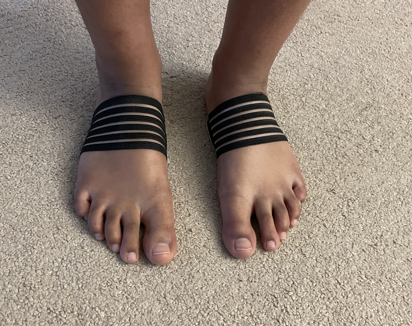 Foot Arch Supports (Cushioned Plantar Fasciitis)(1 Pair)-CPFAS