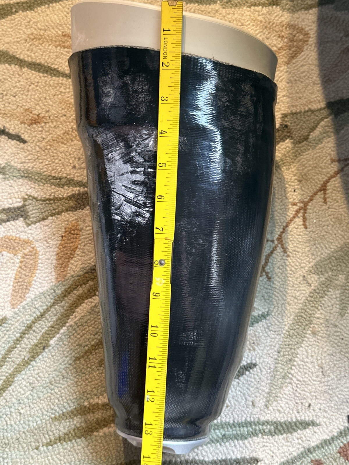 Right Above Knee Prosthetic Socket