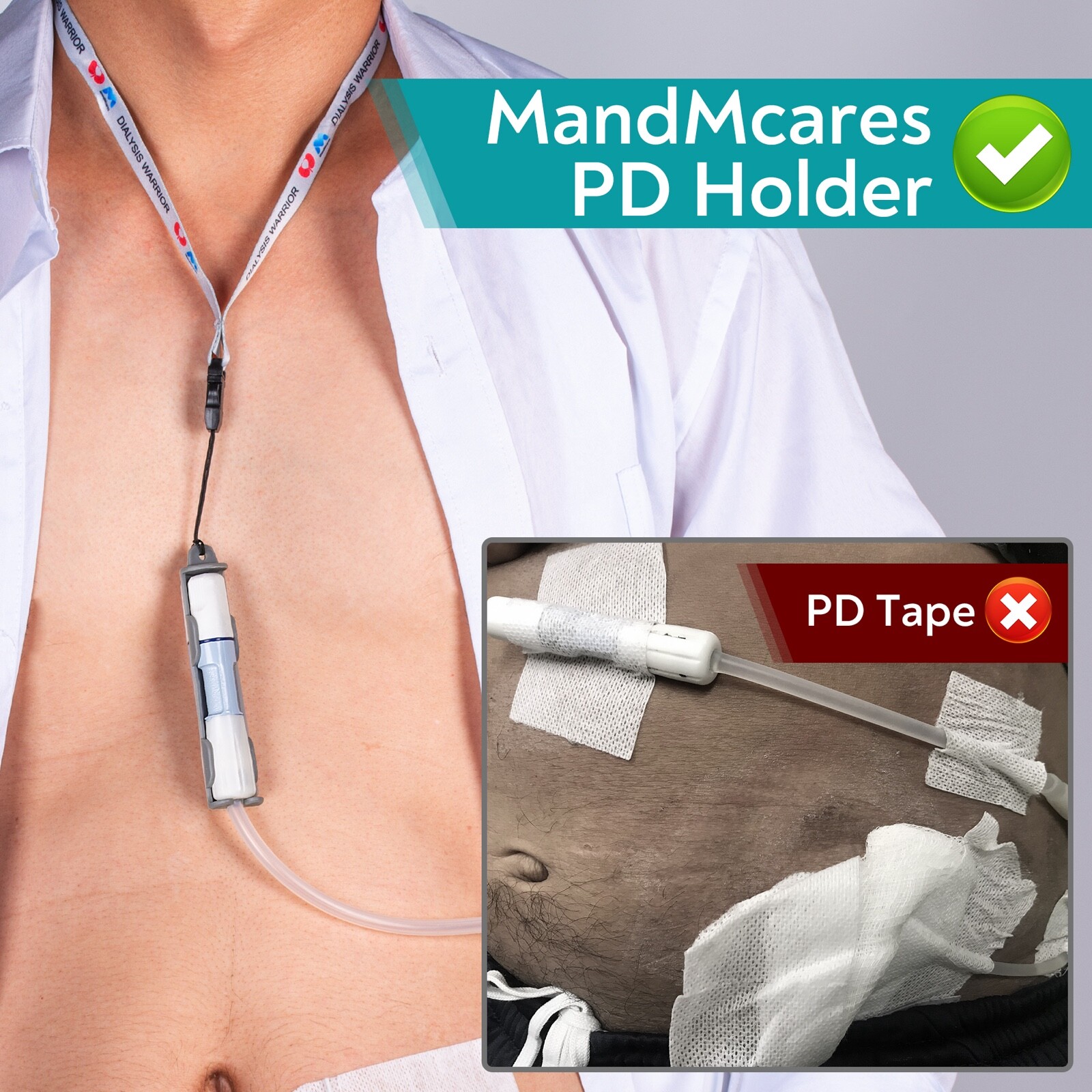 Peritoneal Dialysis Transfer Set Holder for Baxter 2 Lanyard PD Belt Accessories