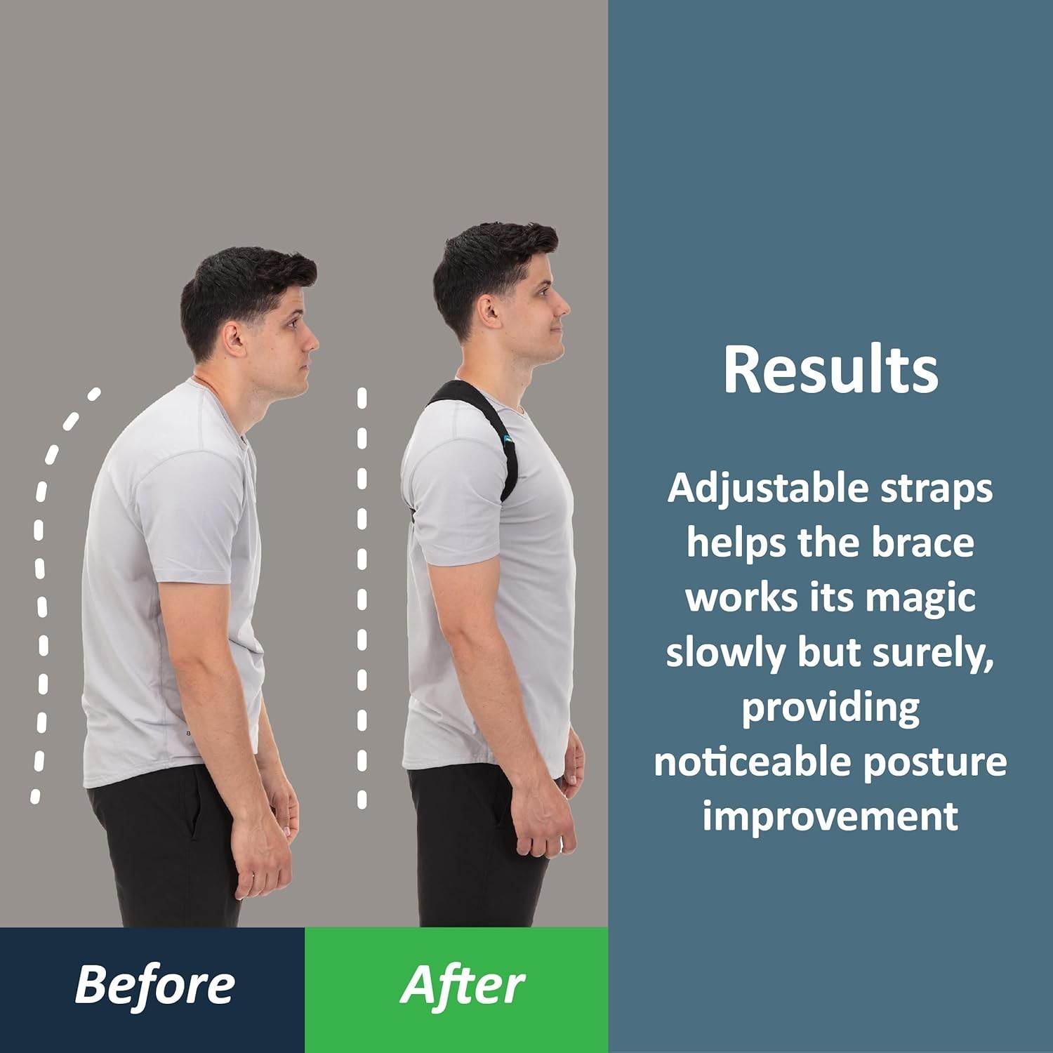 Adjustable Posture Corrector Back Brace Shoulder Support Adult Unisex
