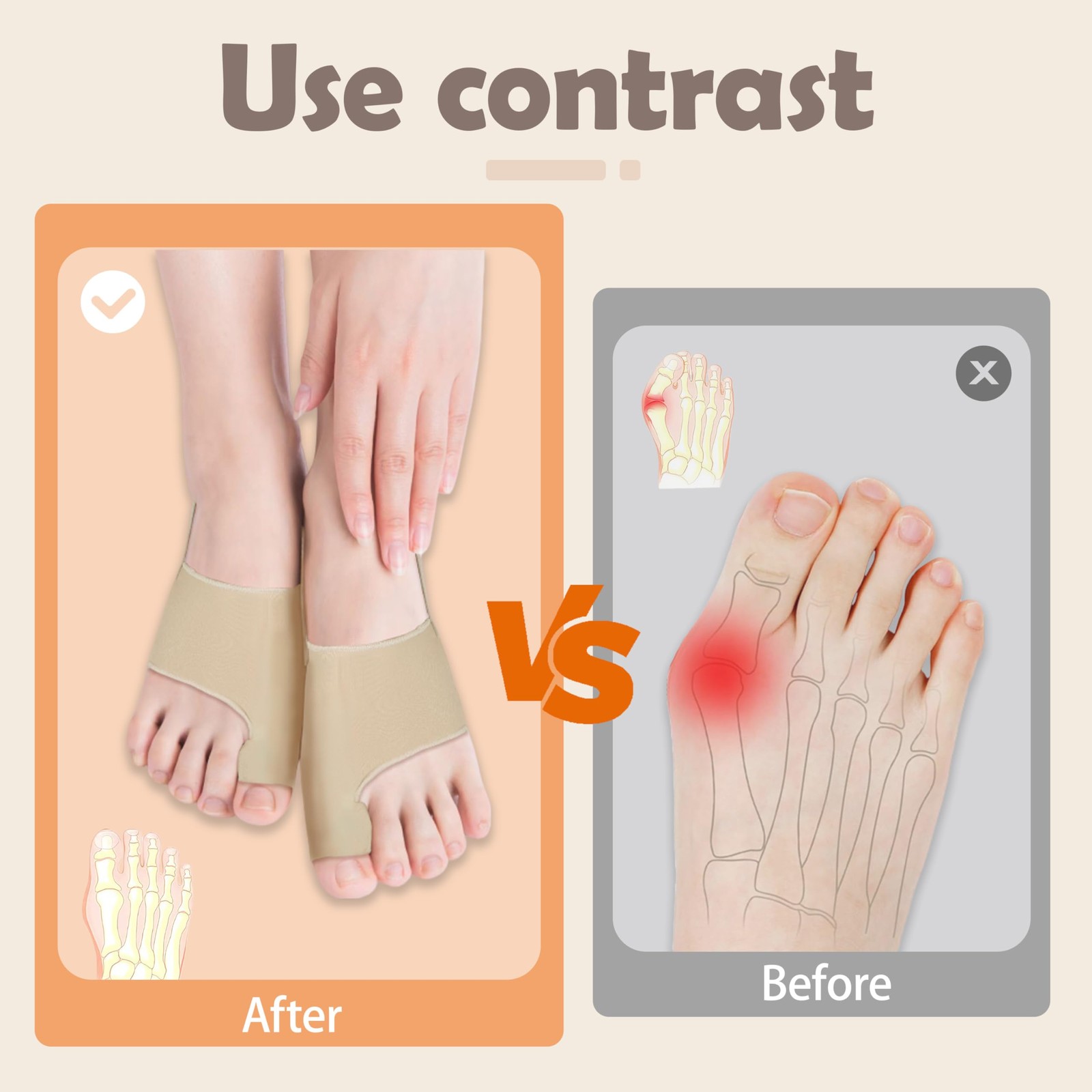 Bunion Corrector Women Men Bunion Splint Socks Big Toe Straightener Sleeve Beige