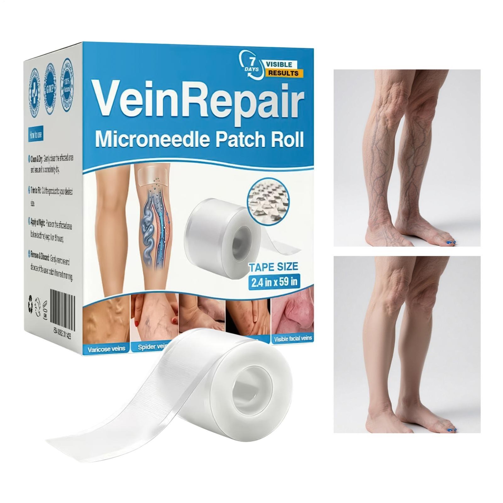 GFOUK Vein Repair Microneedle Patch Roll, GFOUK Vein Repair Patches, Professiona