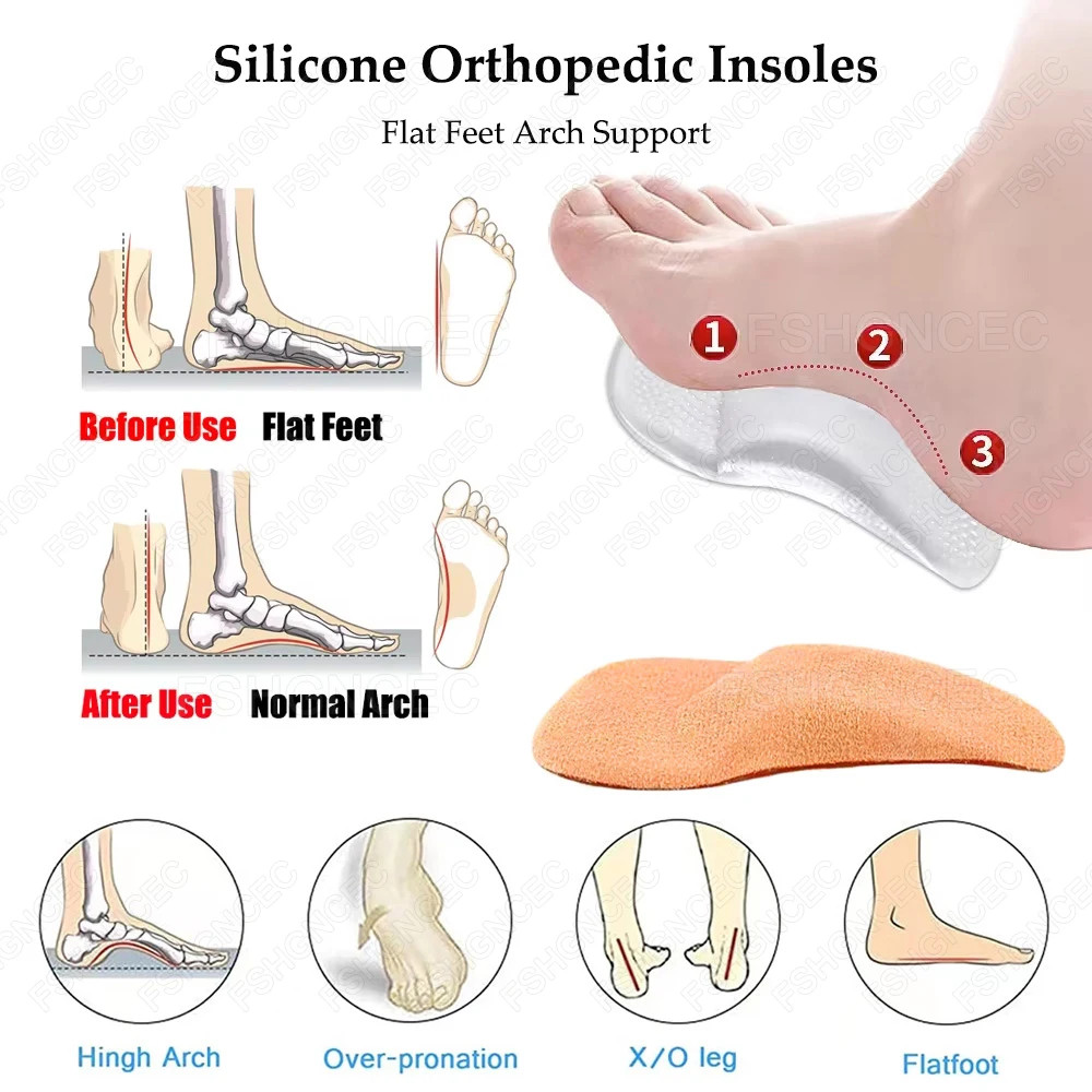 Silicone Arch Support Inserts for Men Women X-Type Legs and Flat Feet Orthopedic