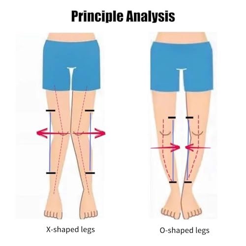 Kids Leg Posture Corrector Brace – O/X Legs Type Straightener for Bow Legs & Val