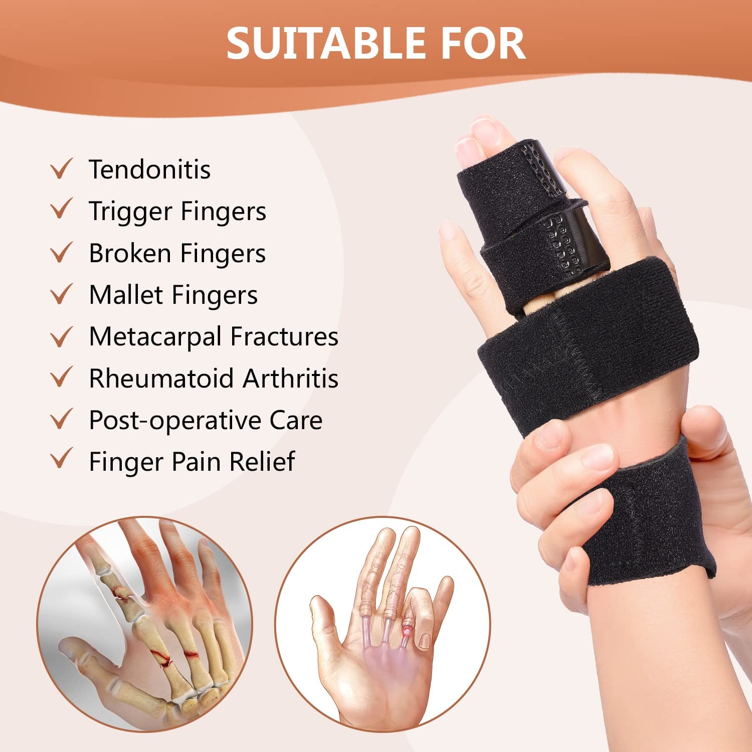 2 Finger Splint, Adjustable Finger Brace, Finger Metal Support for Broken Fin…