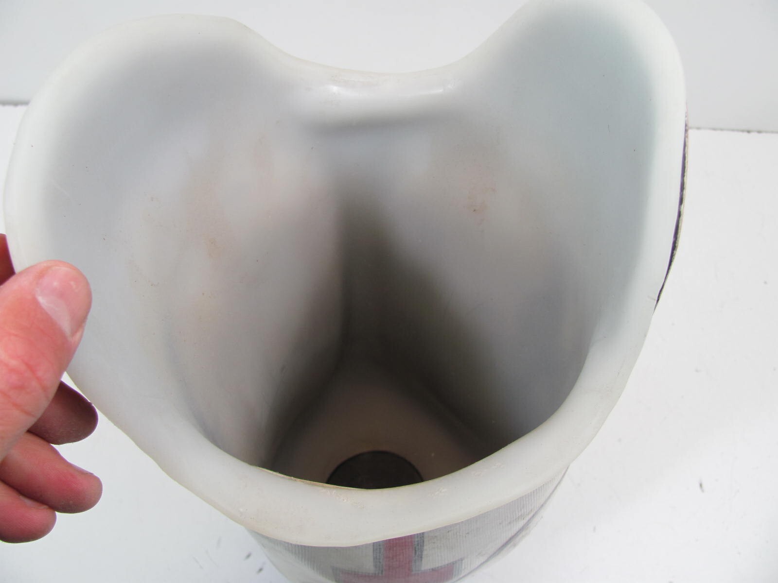 Prosthetic Leg Socket 24