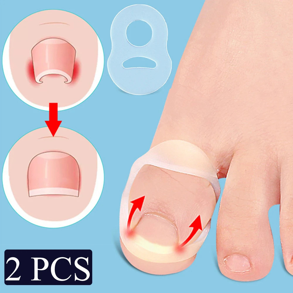 Silicone Ingrown Toenail Correction Tool Invisible Ingrown Toe Nail Straightenin