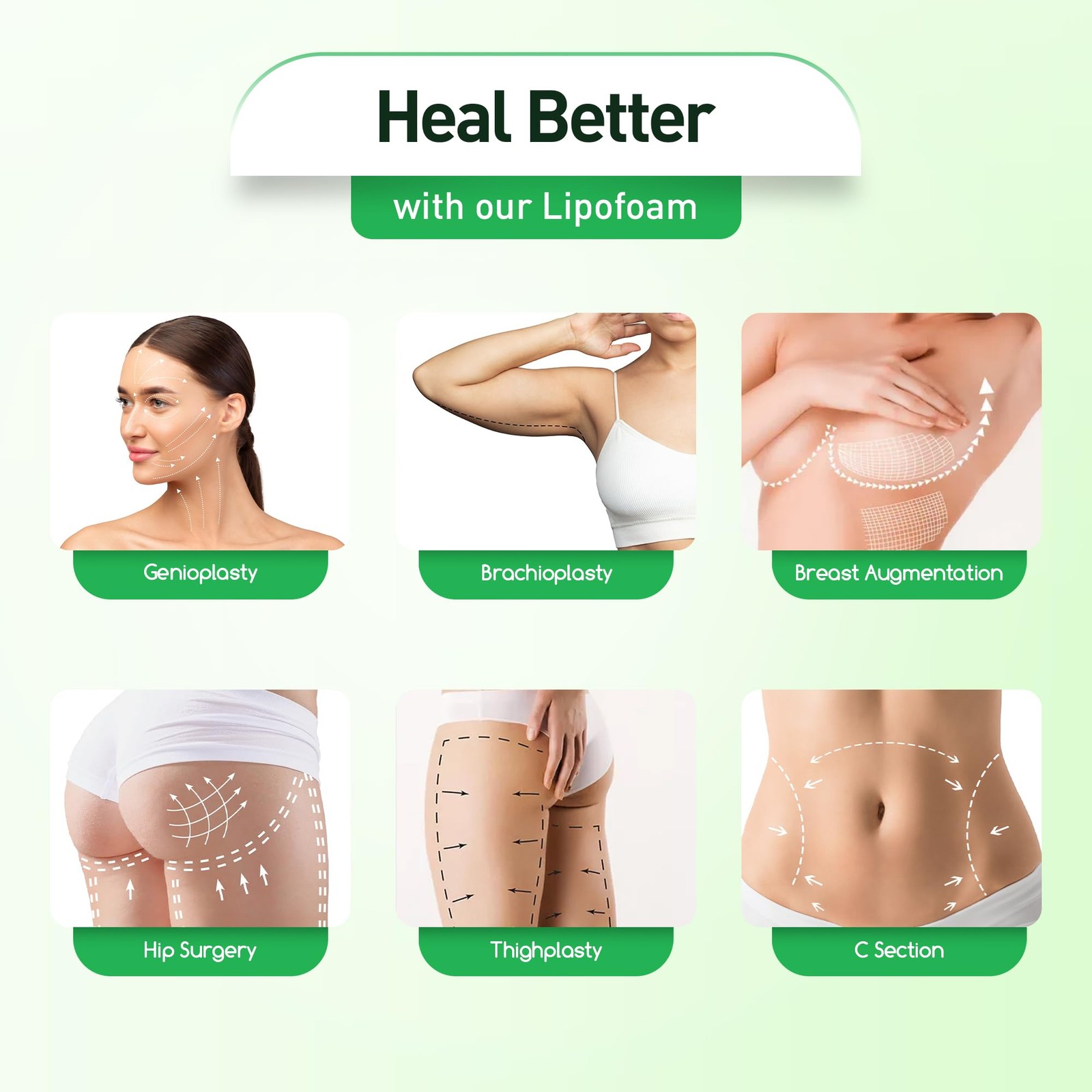 Lipo Foam Pads 3 Pack – Compression Ab Board for Tummy Tuck Recovery
