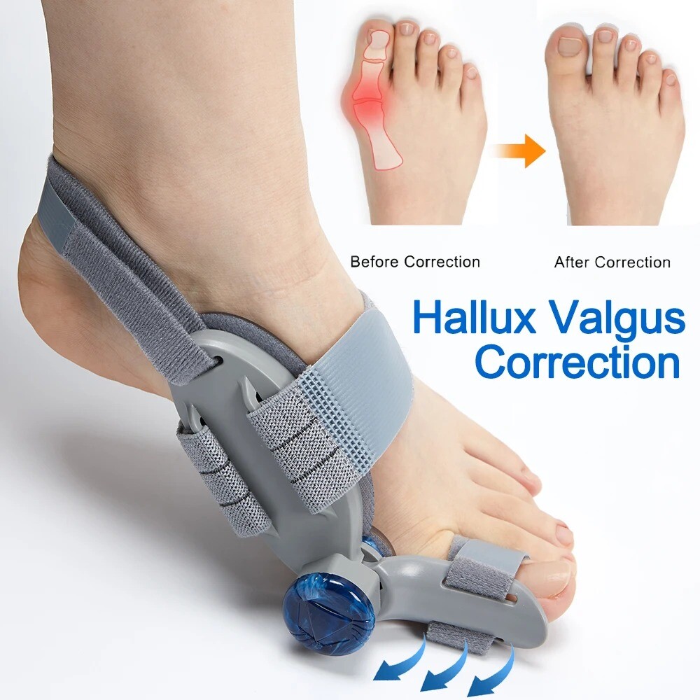 Bunion Splint Big Toe Straightener Hallux Valgus Corrector Orthotics Foot Thumb