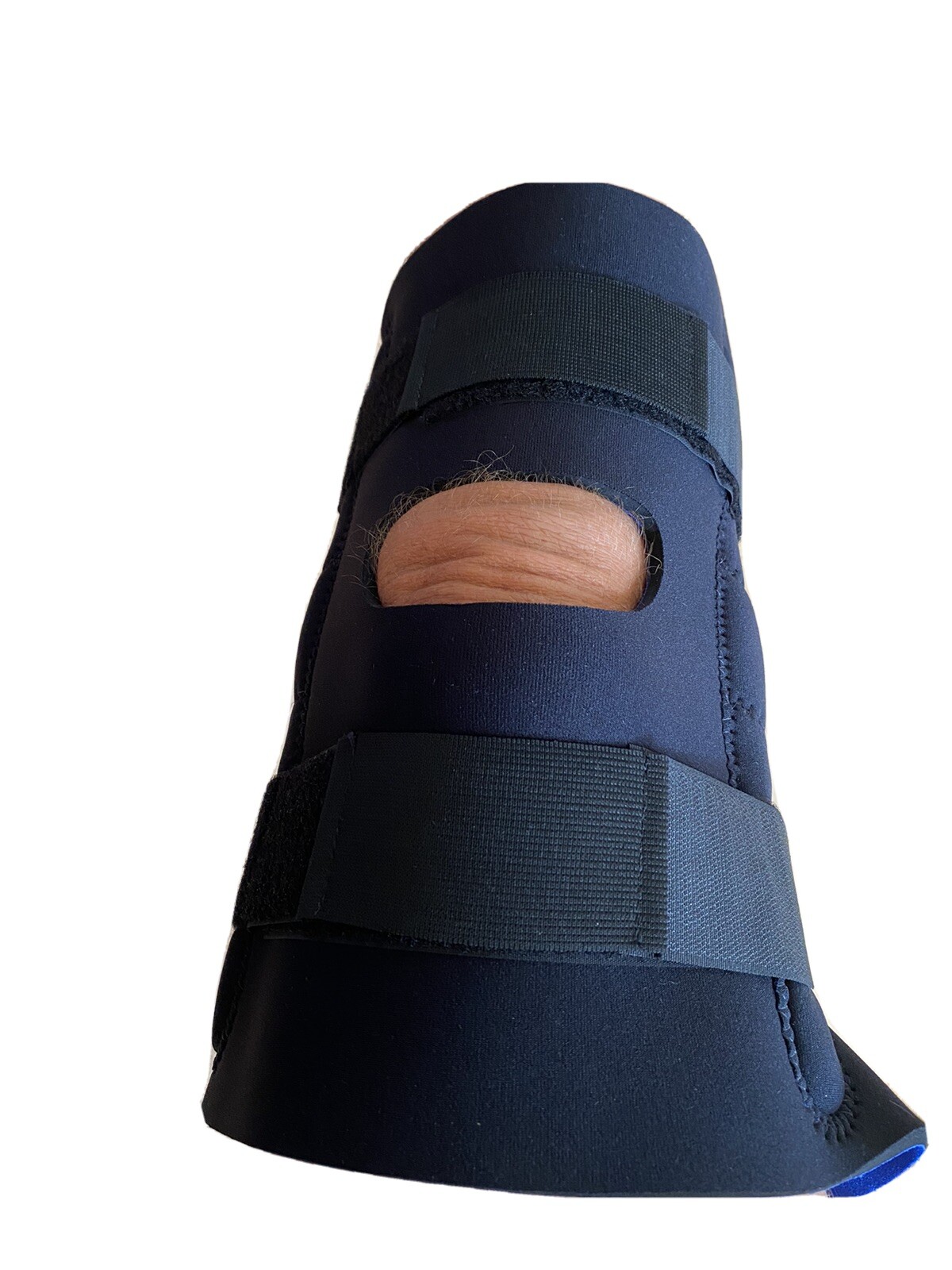 Dynatronics knee Support, Open kneecap Stabilizer with Adjustable Strap Hinged