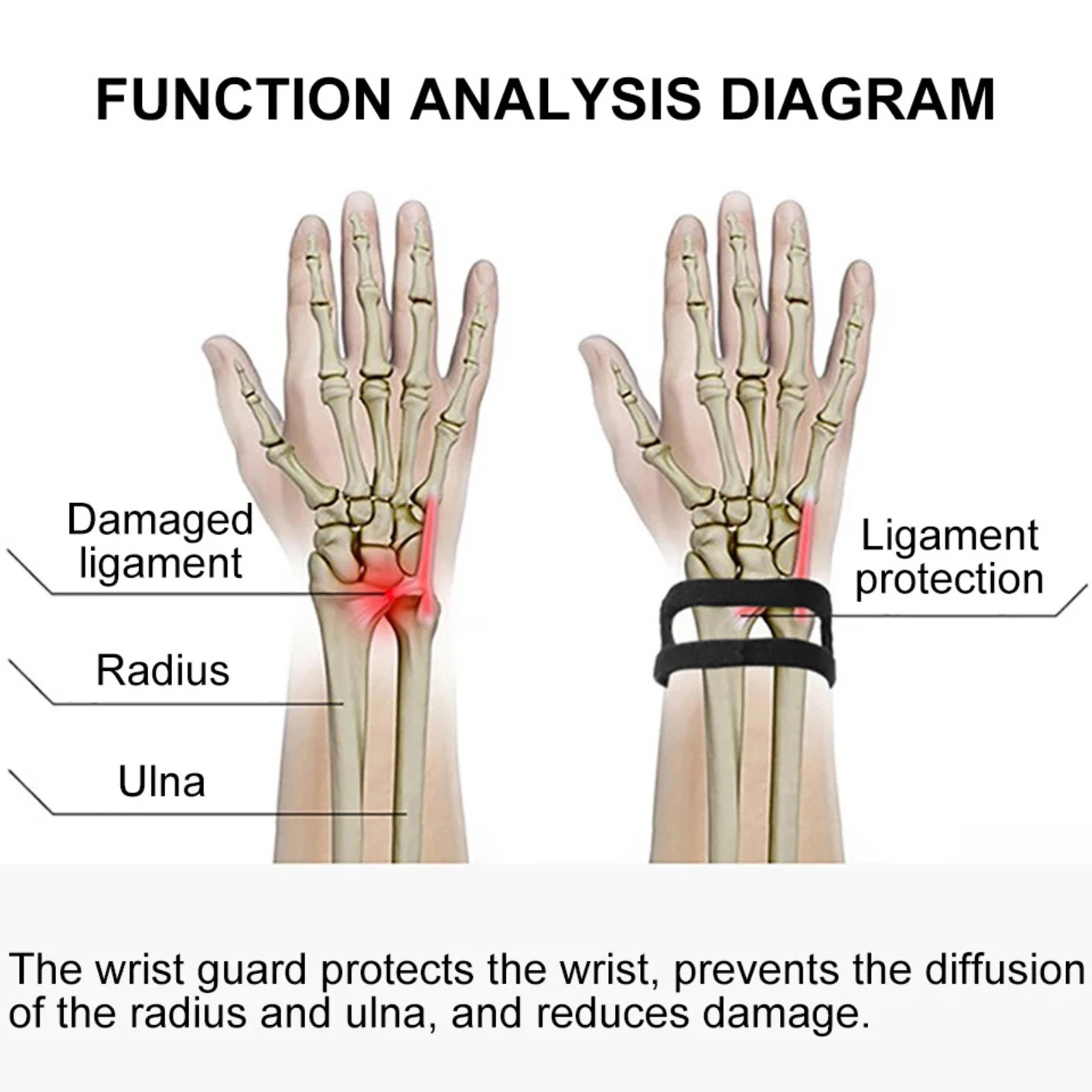 Wrist Widget Wrist Brace for TFCC Tear Ulnar Wrist Band Wrist Wraps