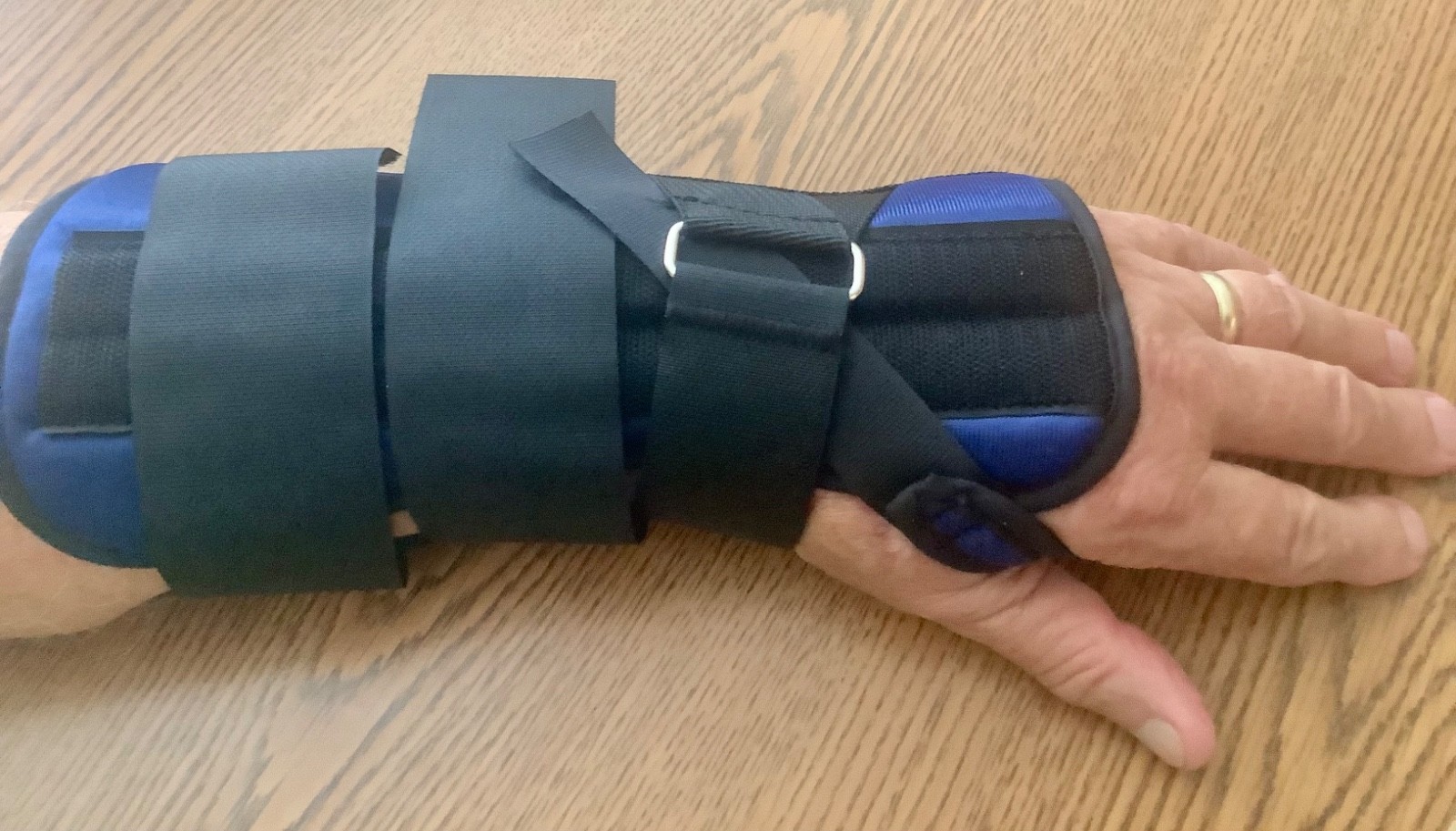 FOAM WRIST SPLINT, LEFT, LARGE, BLUE, PROCARE, STEEL IMMOBILIZATION