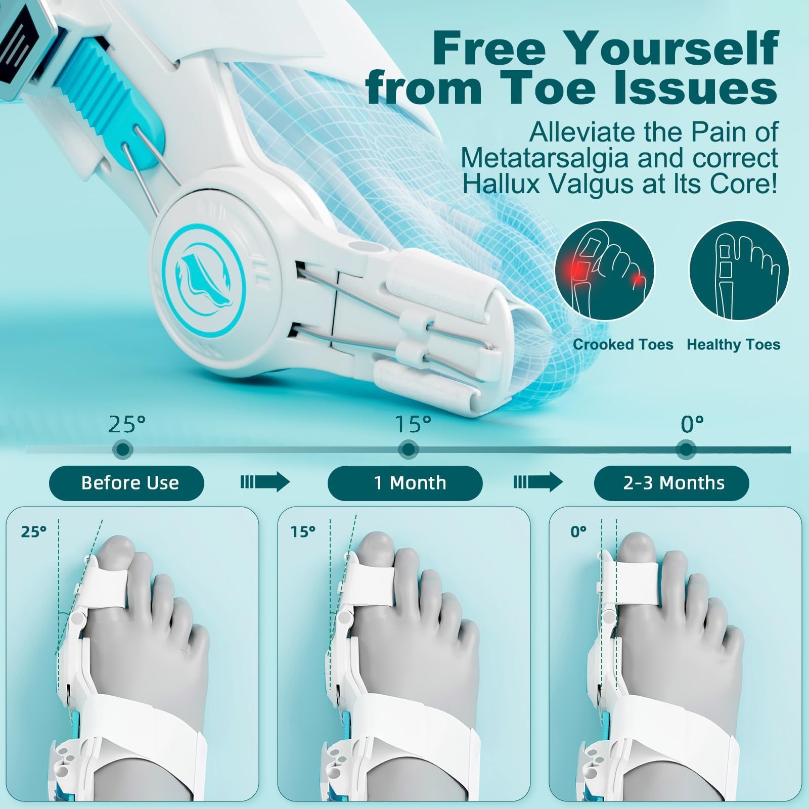 Upgraded Bunion Corrector for Men & Women, Adjustable Toe Splint for Left/Right