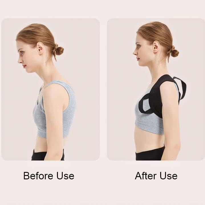 Back Posture Corrector for Women & Men, Kyphosis Relief, Spine Support Brace,…