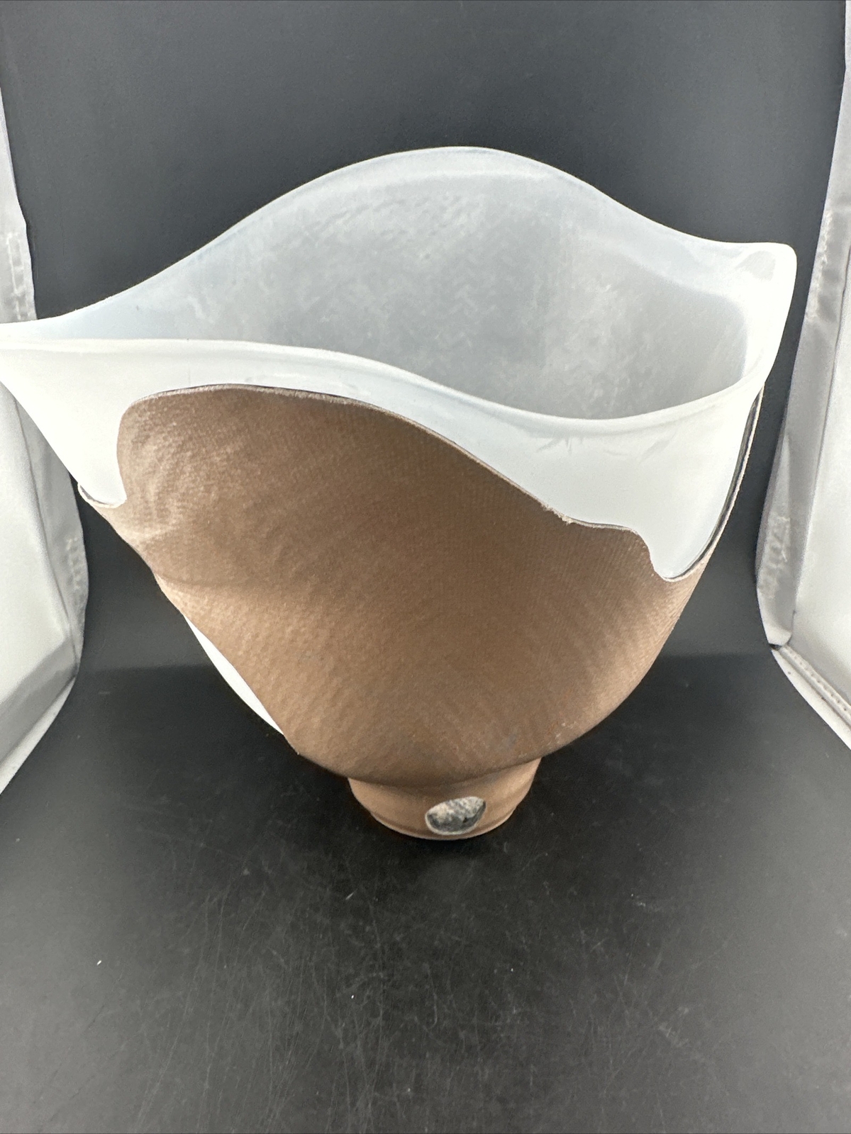 Prosthetic Socket. Prosthetic Leg Socket
