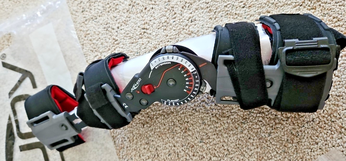 Hinged Lockable Elbow Brace -DonJoy X-Act ROM ~Suits Ligament Injury, Post-Op