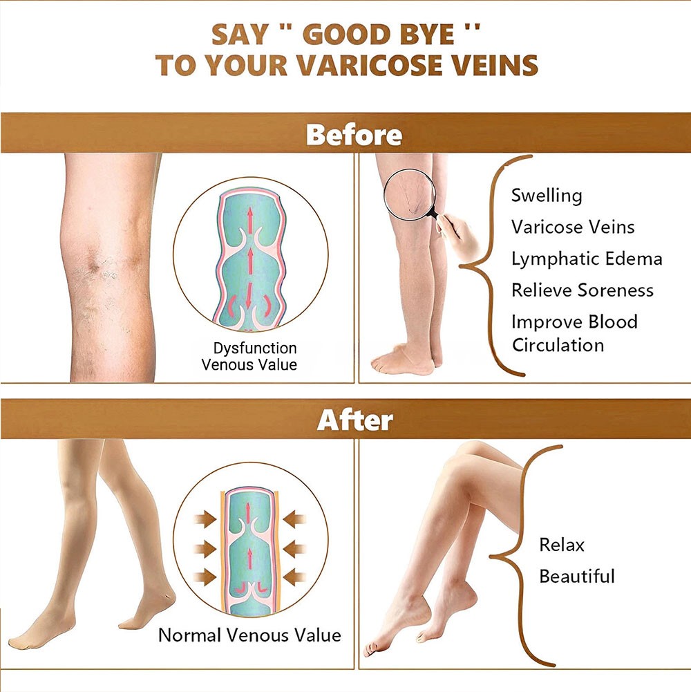 Compression Pantyhose Medical Stockings Varicose Women Men Circulation Grade-II