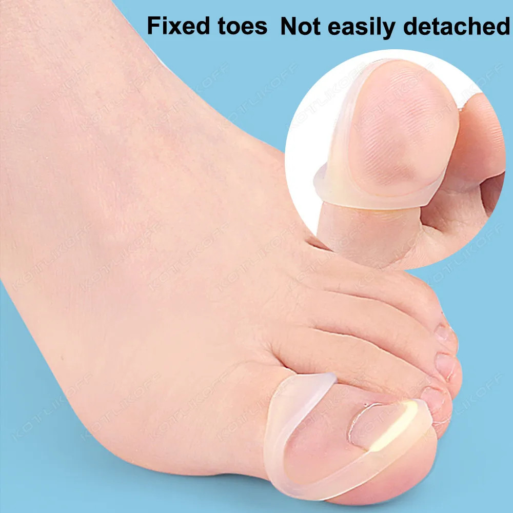 Silicone Ingrown Toenail Correction Tool Invisible Ingrown Toe Nail Straightenin