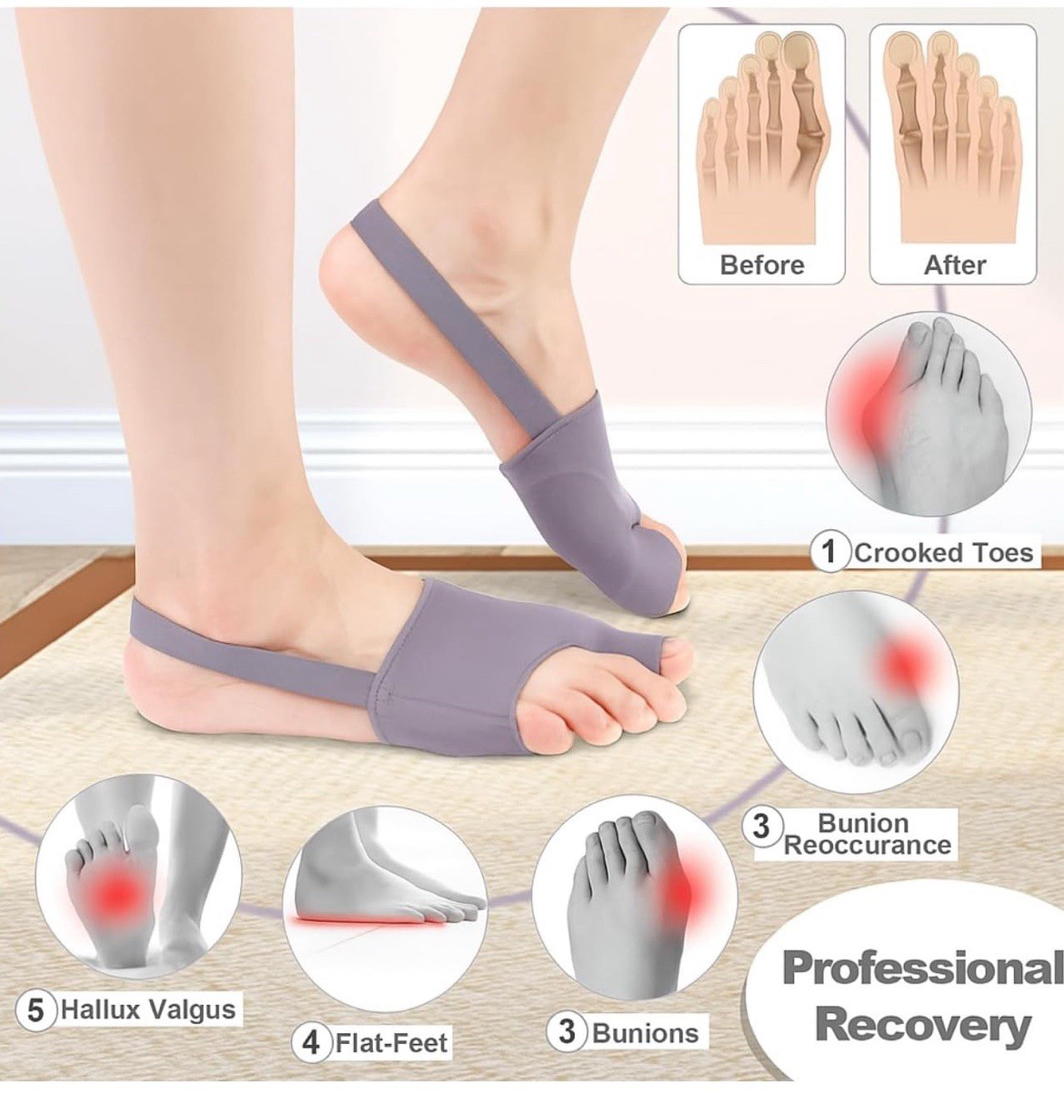 Bunion Corrector for Women Men, 2Pcs Toe Corrector, Adjustable Gray/Black
