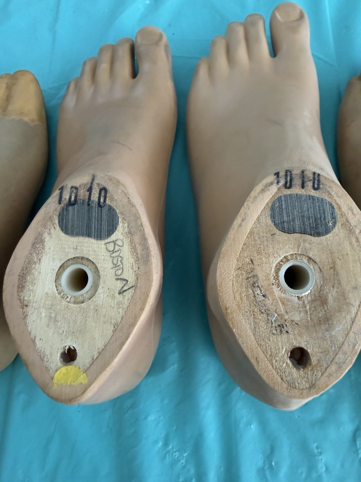 lot of 5 USED PROSTHETIC FEET. 3 OTTO BOCK -2 KINGSLEY JUVENILE