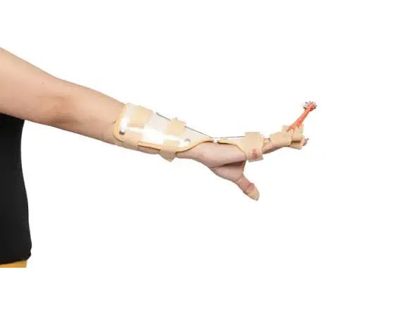 Radial, Nerve Palsy, Stroke Recovery Dynamic Hand Splint With Finger Extension